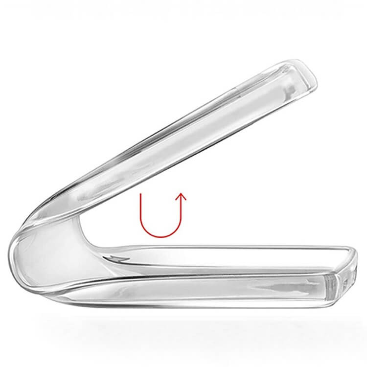 Силиконов Калъф за Nothing Phone 2A/ Plus, GKK Clear Silicone Case, Прозрачен (2)